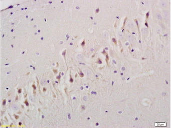 Anti-TGF beta Receptor I antibody used in IHC (Paraffin sections) (IHC-P). GTX04547