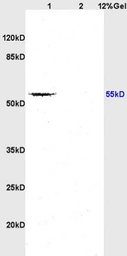Anti-TGF beta Receptor I antibody used in Western Blot (WB). GTX04547