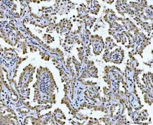 Anti-GLIS1 antibody used in IHC (Paraffin sections) (IHC-P). GTX04548