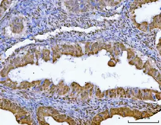 Anti-GLIS1 antibody used in IHC (Paraffin sections) (IHC-P). GTX04548