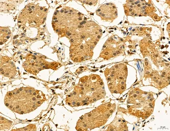 Anti-TIP47 antibody used in IHC (Paraffin sections) (IHC-P). GTX04559
