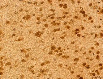 Anti-TIP47 antibody used in IHC (Paraffin sections) (IHC-P). GTX04559