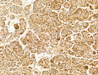 Anti-TIP47 antibody used in IHC (Paraffin sections) (IHC-P). GTX04559