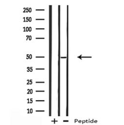 Anti-TIP47 antibody used in Western Blot (WB). GTX04559