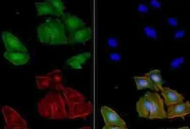Anti-Adenosine A2a Receptor antibody [7F6-G5-A2] used in Immunocytochemistry/ Immunofluorescence (ICC/IF). GTX04561