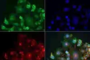 Anti-Adenosine A2a Receptor antibody [7F6-G5-A2] used in Immunocytochemistry/ Immunofluorescence (ICC/IF). GTX04561