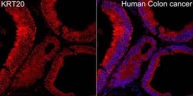 Anti-Cytokeratin 20 antibody used in IHC (Paraffin sections) (IHC-P). GTX04562