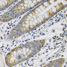 Anti-Cytokeratin 20 antibody used in IHC (Paraffin sections) (IHC-P). GTX04562