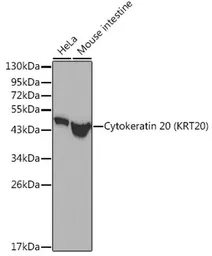 Anti-Cytokeratin 20 antibody used in Western Blot (WB). GTX04562