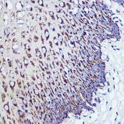 Anti-ORP8 antibody used in IHC (Paraffin sections) (IHC-P). GTX04576