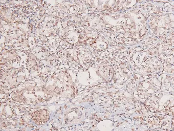 Anti-GCN2 (phospho Thr899) antibody used in IHC (Paraffin sections) (IHC-P). GTX04588