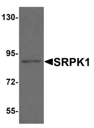 Anti-SRPK1 antibody used in Western Blot (WB). GTX04611