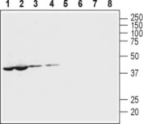 Anti-Pannexin 1 antibody used in Western Blot (WB). GTX04619