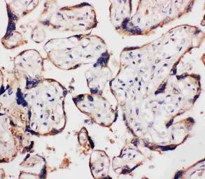 Anti-WISP1 antibody used in IHC (Paraffin sections) (IHC-P). GTX04633