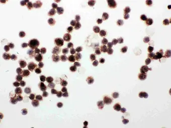 Anti-WISP1 antibody used in IHC-P (cell pellet) (IHC-P (cell pellet)). GTX04633