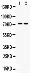 Anti-MDMX / MDM4 antibody used in Western Blot (WB). GTX04638