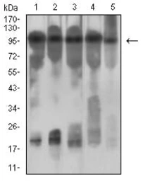 Anti-IL3 Receptor beta antibody [1D5E4] used in Western Blot (WB). GTX04642