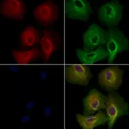 Anti-SCD antibody used in Immunocytochemistry/ Immunofluorescence (ICC/IF). GTX04644