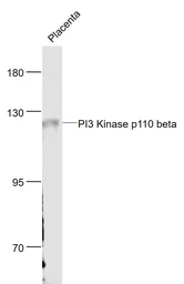 Anti-PI3 kinase p110 beta antibody used in Western Blot (WB). GTX04662
