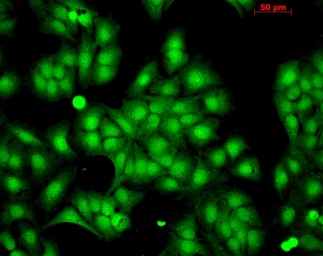 Anti-HSP22 antibody used in Immunocytochemistry/ Immunofluorescence (ICC/IF). GTX04663