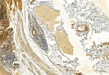 Anti-FAP antibody used in IHC (Paraffin sections) (IHC-P). GTX04673
