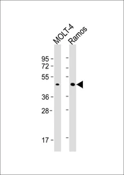 Anti-BCAT1 antibody used in Western Blot (WB). GTX04695