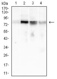 Anti-CD79a antibody [4A10D12] used in Western Blot (WB). GTX04701