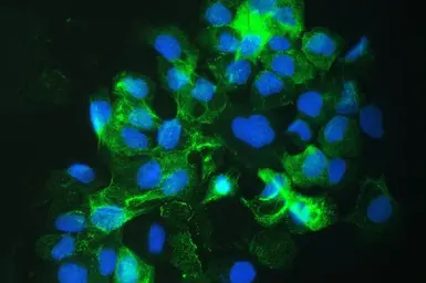 Anti-SLC34A2 antibody used in Immunocytochemistry/ Immunofluorescence (ICC/IF). GTX04719