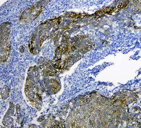 Anti-SLC34A2 antibody used in IHC (Paraffin sections) (IHC-P). GTX04719