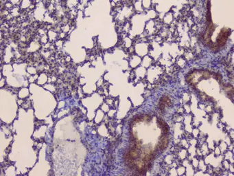 Anti-SLC34A2 antibody used in IHC (Paraffin sections) (IHC-P). GTX04719