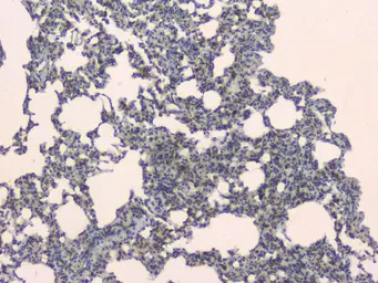 Anti-SLC34A2 antibody used in IHC (Paraffin sections) (IHC-P). GTX04719
