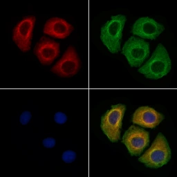 Anti-Calcitonin Receptor antibody used in Immunocytochemistry/ Immunofluorescence (ICC/IF). GTX04724