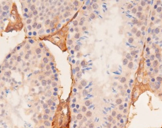 Anti-YAP1 (phospho Ser127) antibody used in IHC (Paraffin sections) (IHC-P). GTX04728