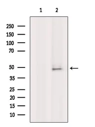 Anti-Fc epsilon R1 alpha antibody used in Western Blot (WB). GTX04729