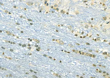 Anti-PEA3 antibody used in IHC (Paraffin sections) (IHC-P). GTX04730