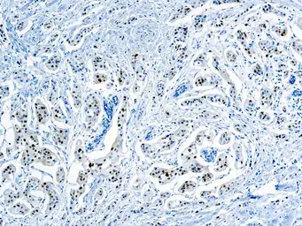 Anti-Cyclin D1 antibody [SP4] used in IHC (Paraffin sections) (IHC-P). GTX04738
