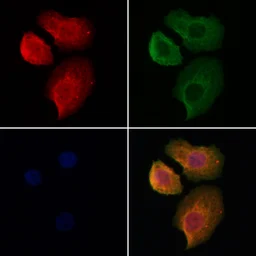 Anti-Hemoglobin alpha antibody used in Immunocytochemistry/ Immunofluorescence (ICC/IF). GTX04751