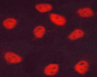 Anti-Estrogen Receptor beta (phospho Ser105) antibody used in Immunocytochemistry/ Immunofluorescence (ICC/IF). GTX04765