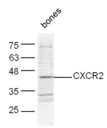 Anti-CXCR2 antibody used in Western Blot (WB). GTX04768