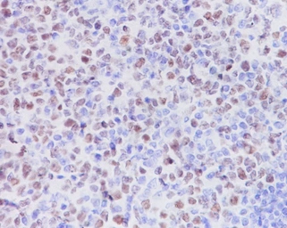 Anti-EZH2 antibody [IDF-5] used in IHC (Paraffin sections) (IHC-P). GTX04778