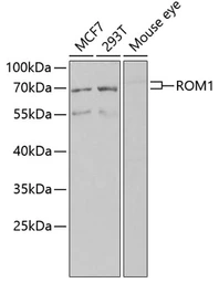 Anti-ROM1 antibody used in Western Blot (WB). GTX04780