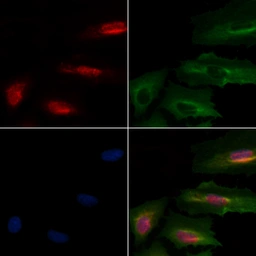 Anti-BRN3A antibody used in Immunocytochemistry/ Immunofluorescence (ICC/IF). GTX04795
