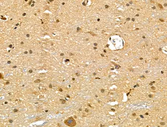 Anti-BRN3A antibody used in IHC (Paraffin sections) (IHC-P). GTX04795
