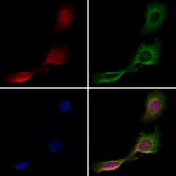 Anti-DCP1A antibody used in Immunocytochemistry/ Immunofluorescence (ICC/IF). GTX04801
