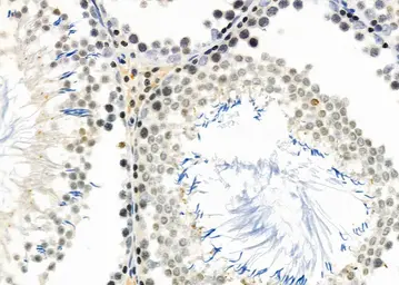 Anti-DCP1A antibody used in IHC (Paraffin sections) (IHC-P). GTX04801