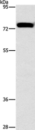 Anti-ALOX15 antibody used in Western Blot (WB). GTX04843