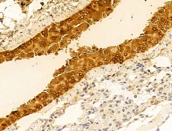 Anti-MMP13 antibody used in IHC (Paraffin sections) (IHC-P). GTX04845