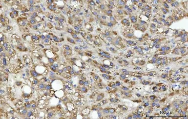 Anti-SEPT9 antibody used in IHC (Paraffin sections) (IHC-P). GTX04846