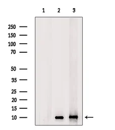 Anti-GnRH1 antibody used in Western Blot (WB). GTX04860