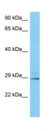 Anti-NKX2.8 antibody used in Western Blot (WB). GTX04864